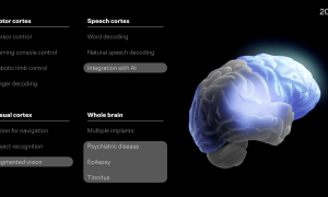 马斯克Neuralink疯狂计划曝光：5万美元一台手术，要把人类变成“超能力机器人”